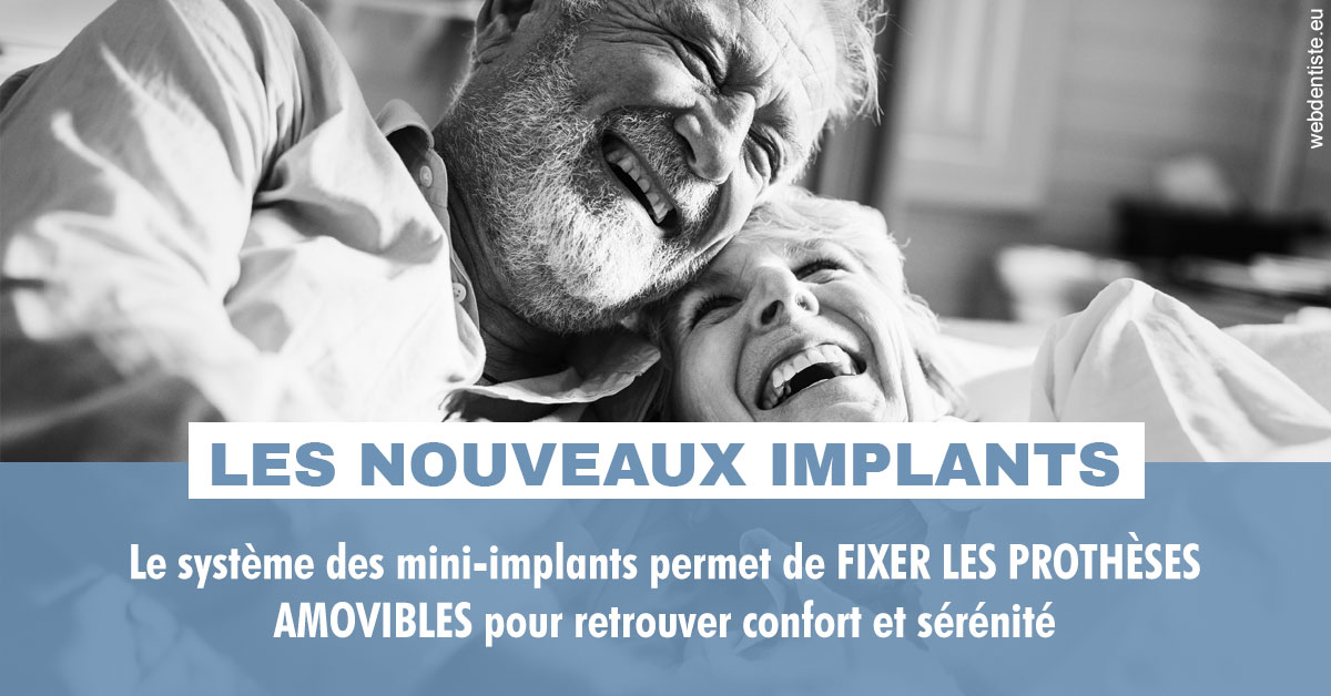 https://dr-jacques-sebastien.chirurgiens-dentistes.fr/Les nouveaux implants 2