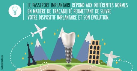 https://dr-jacques-sebastien.chirurgiens-dentistes.fr/Le passeport implantaire