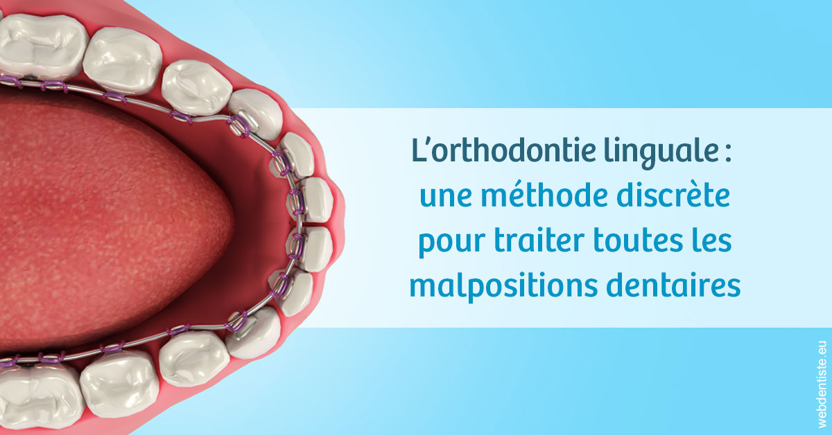 https://dr-jacques-sebastien.chirurgiens-dentistes.fr/L'orthodontie linguale 1