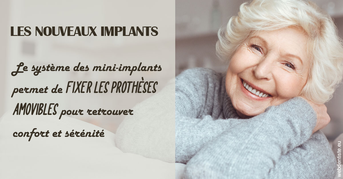 https://dr-jacques-sebastien.chirurgiens-dentistes.fr/Les nouveaux implants 1
