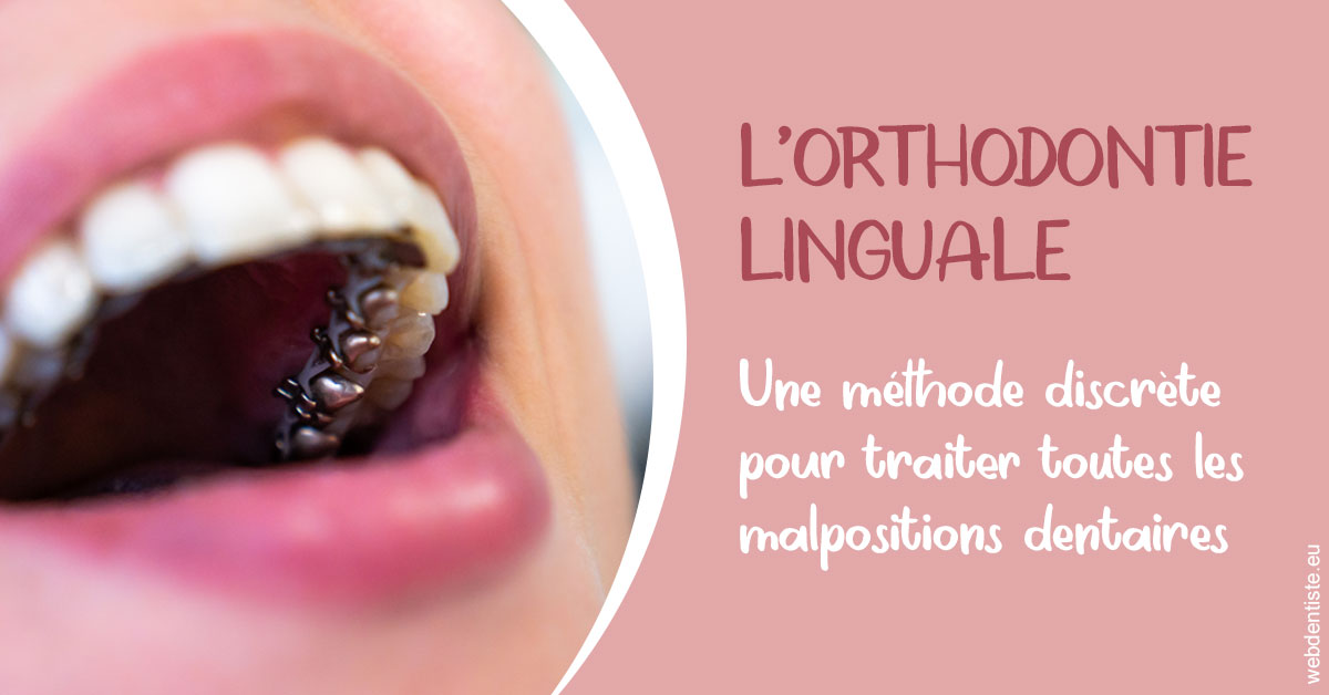 https://dr-jacques-sebastien.chirurgiens-dentistes.fr/L'orthodontie linguale 2