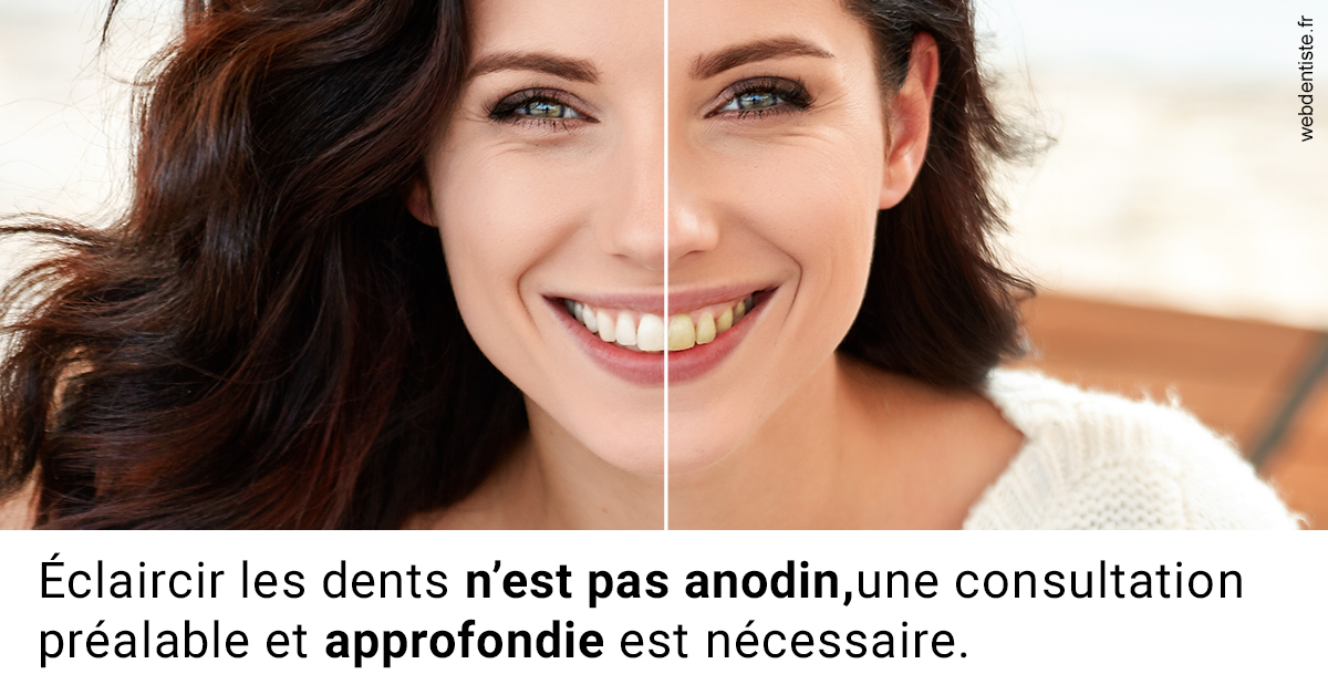 https://dr-jacques-sebastien.chirurgiens-dentistes.fr/Le blanchiment 2