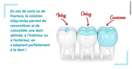 https://dr-jacques-sebastien.chirurgiens-dentistes.fr/L'INLAY ou l'ONLAY