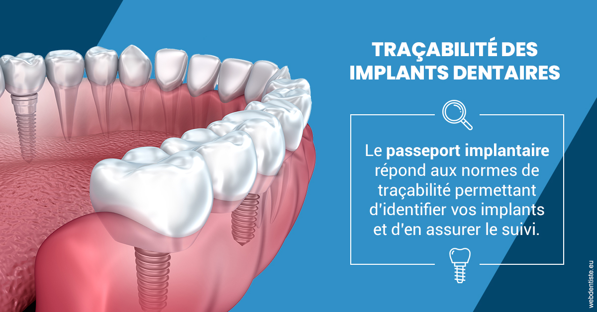 https://dr-jacques-sebastien.chirurgiens-dentistes.fr/T2 2023 - Traçabilité des implants 1