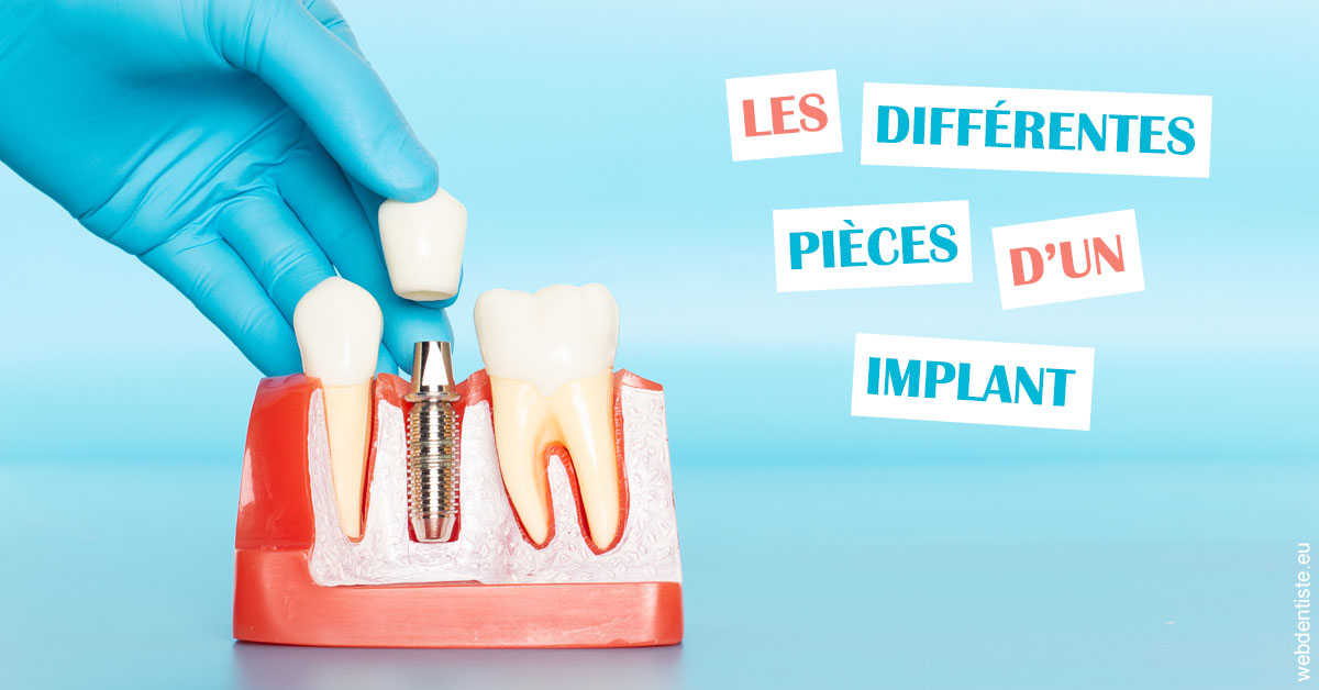 https://dr-jacques-sebastien.chirurgiens-dentistes.fr/Les différentes pièces d’un implant 2