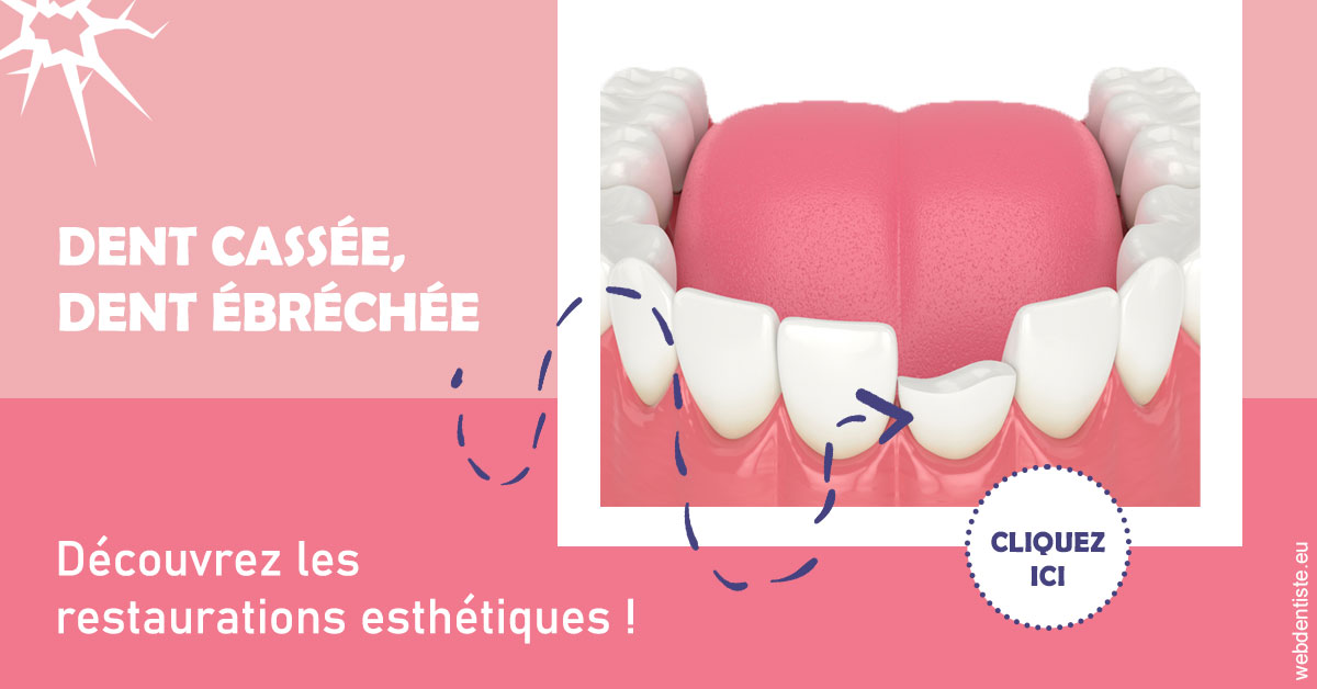 https://dr-jacques-sebastien.chirurgiens-dentistes.fr/Dent cassée ébréchée 1