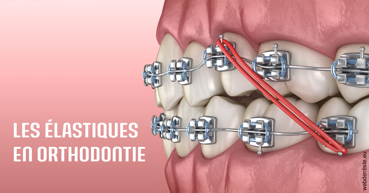 https://dr-jacques-sebastien.chirurgiens-dentistes.fr/Elastiques orthodontie 2