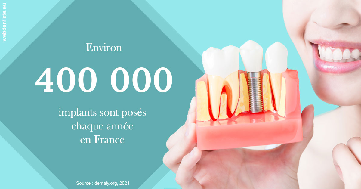 https://dr-jacques-sebastien.chirurgiens-dentistes.fr/Pose d'implants en France 2